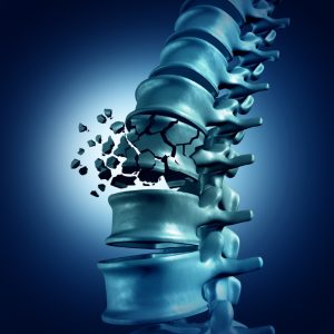 Spinal Fracture and traumatic vertebral injury