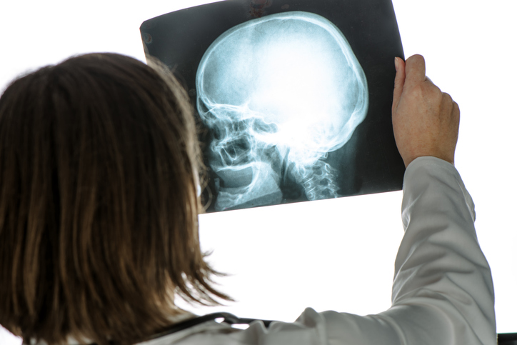 Doctor analyzing human skull x-ray