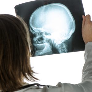 Doctor analyzing human skull x-ray