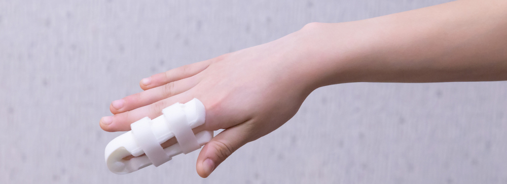 A person with a broken finger in a finger splint